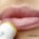 CBD bei Herpes